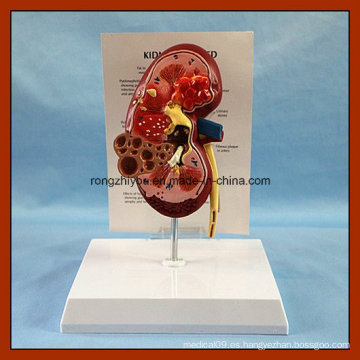Modelo humano del riñón humano del PVC para la venta